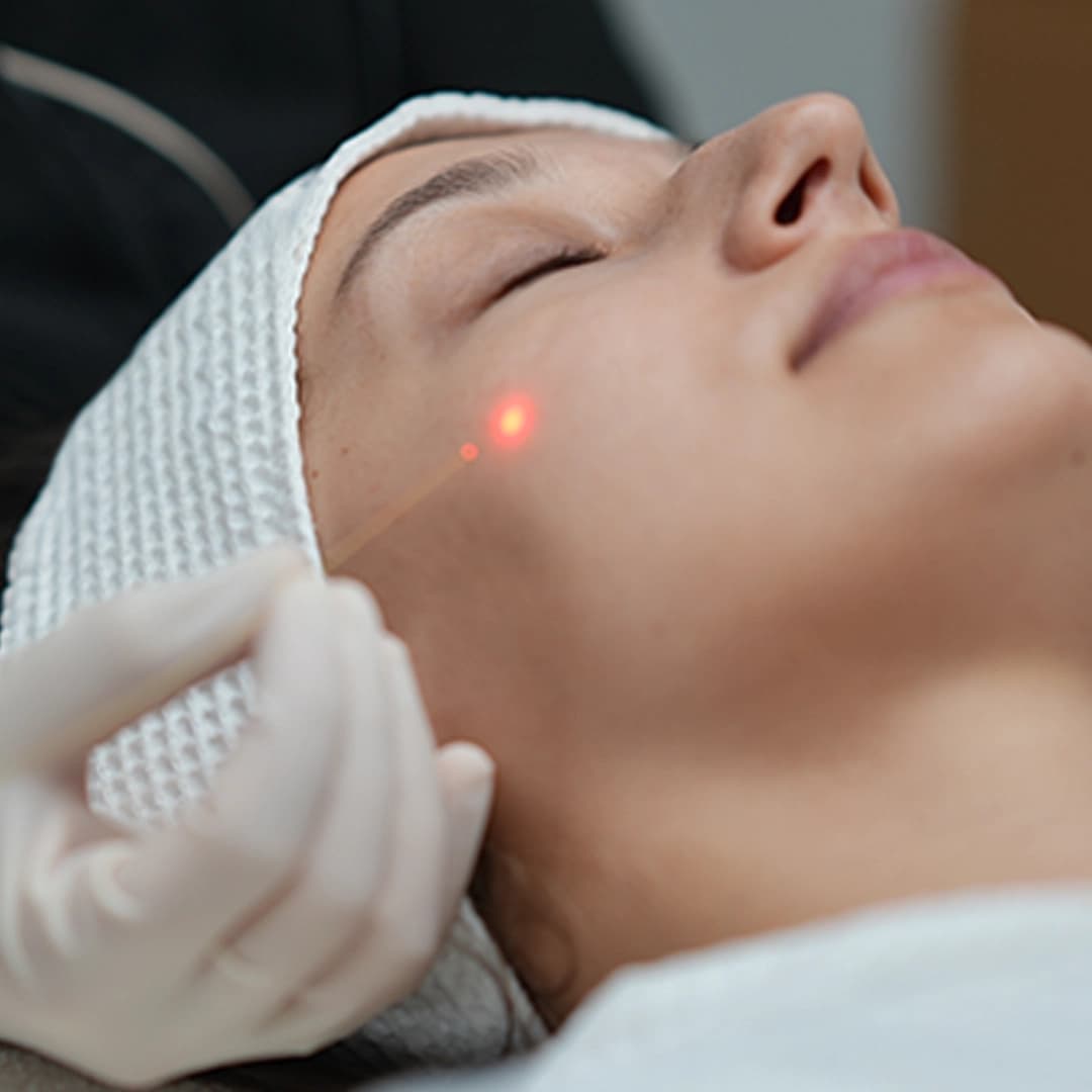 Endolift